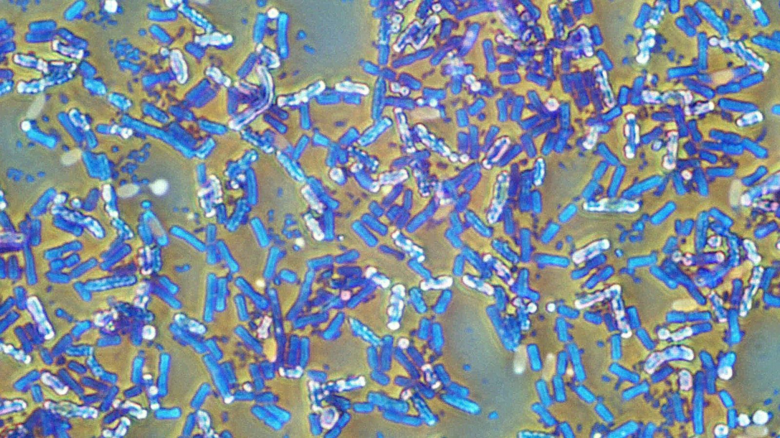 Hibernating bacteria can invade hospitals and survive outer space—but their energy budget reveals a weakness