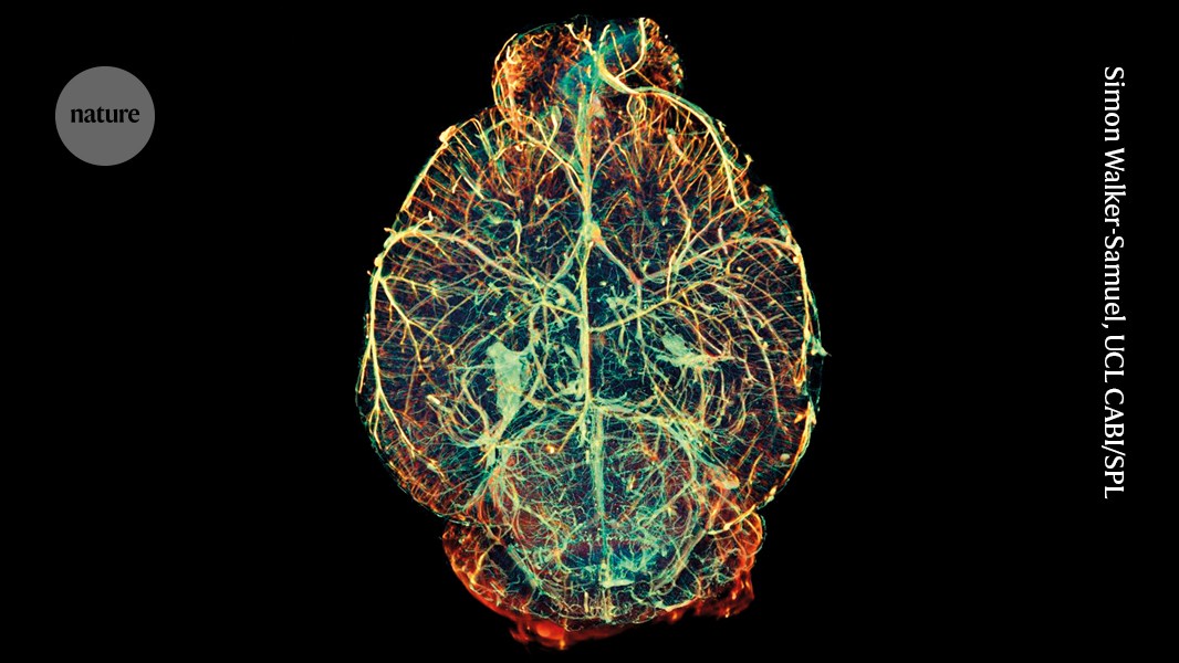 How to make a brain: new experiments challenge existing picture