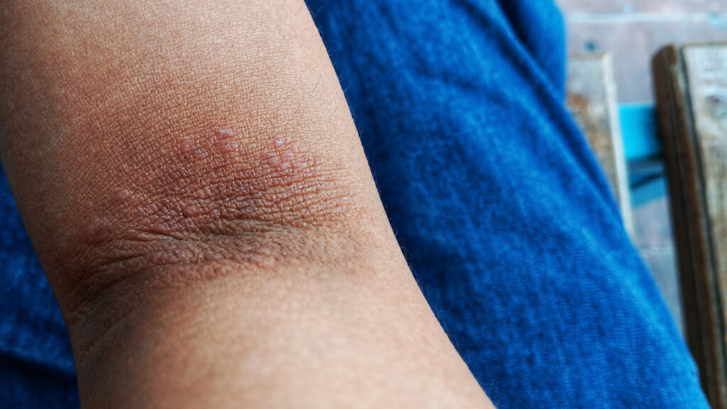 STAT+: A biotech hedge fund births a new immunology company