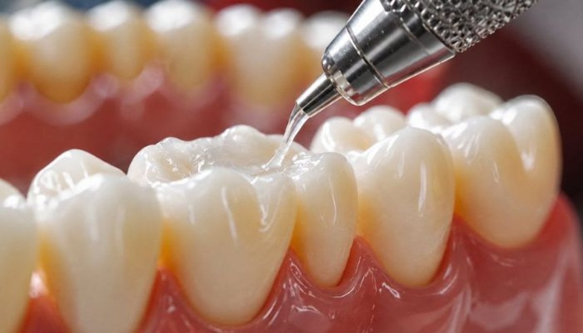 University of Nottingham researchers say new gel could regrow tooth enamel in weeks