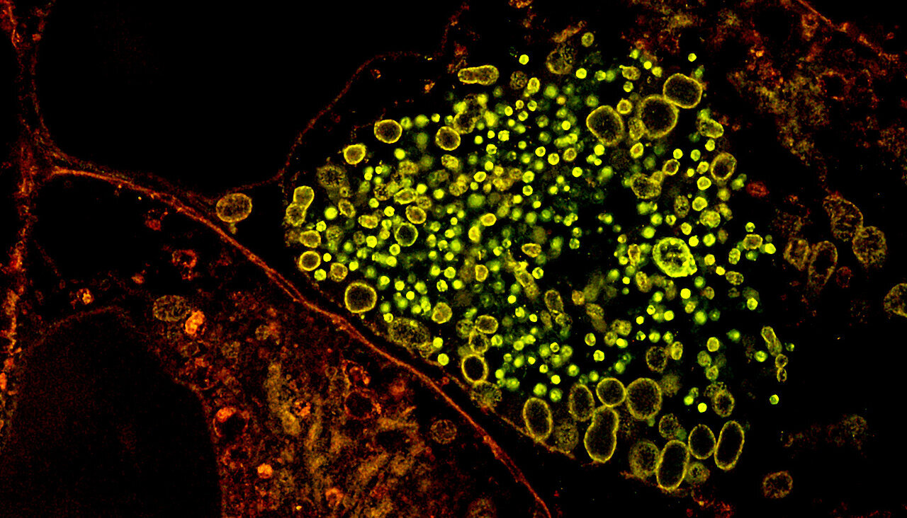 Chlamydia packs DNA with lipids, revealing possible target for blocking infection