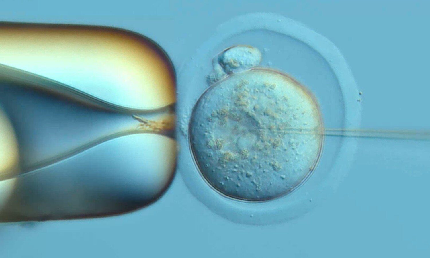 'DNA Typewriter' records cells' history in developing mouse embryo