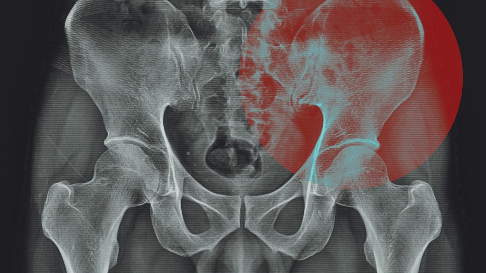 Do we really ‘hold tension’ in our hips?