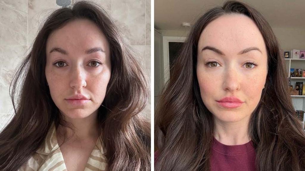 Is 'ferritin face' a real thing - and can you really spot low iron from looks?