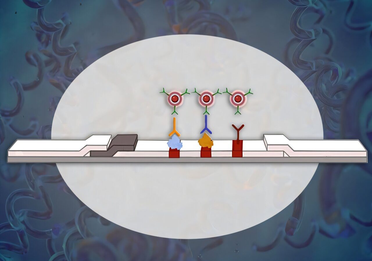 One-step rapid syphilis test uses layered nanoparticles to detect infection earlier