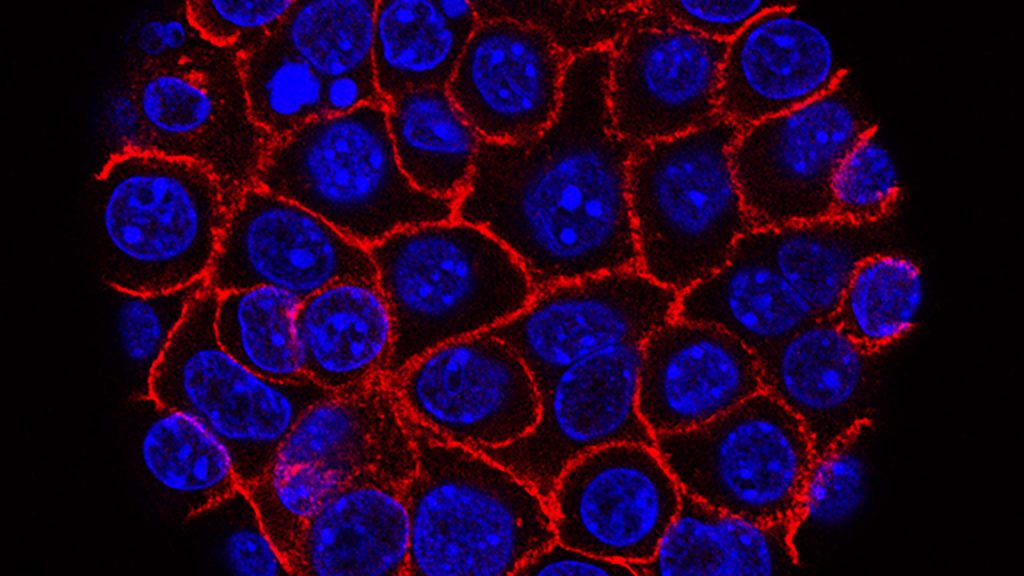 STAT+: Tango builds on Revolution Medicines’ pancreatic cancer success
