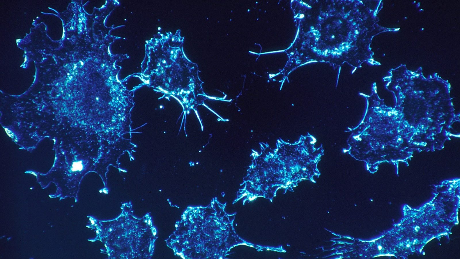 Sustained pressure halts cancer cell migration and triggers death in 3D lab models