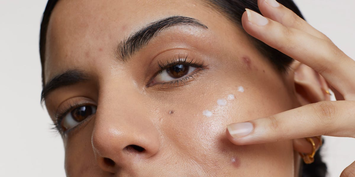 The Ultimate Guide to Over-the-Counter Dark Spot Treatments