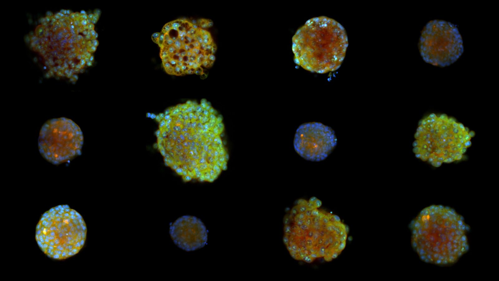 Transparent minispheres reveal that some look-alike cancer drugs part ways in 3D
