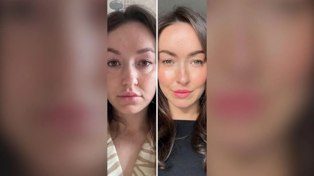 Can you tell ferritin levels from your face?